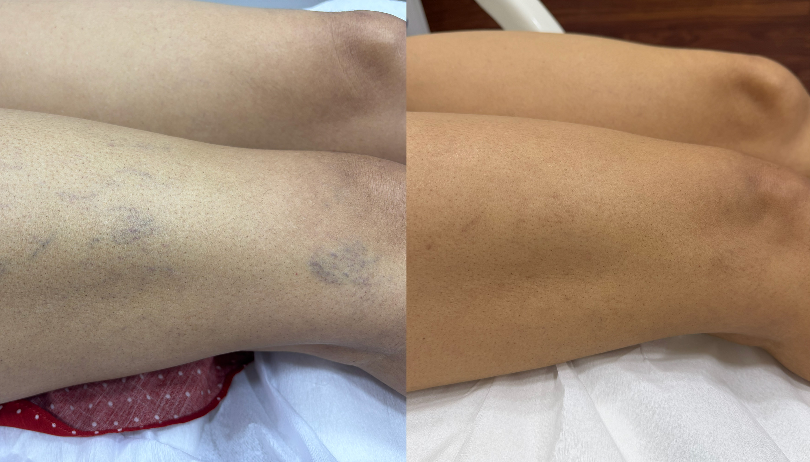 Caso 01 — Antes e Depois